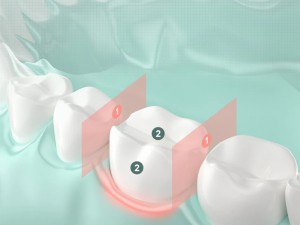 دستگاه شست و شوی دهان و دندان شارژی شیائومی مدل Mint 3
