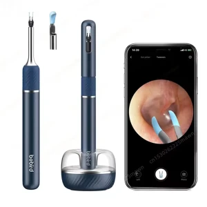 گوش پاک کن هوشمند شیائومی مدل  NOTE 5